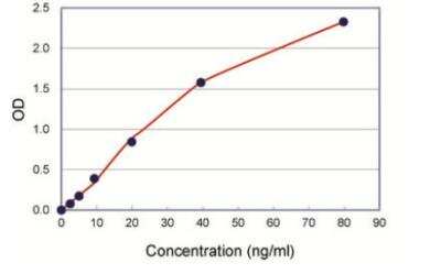 ELISA: Human SAA ELISA Kit (Colorimetric) [KA0518]